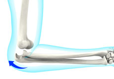 Elbow Instability